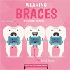 Wearing Braces